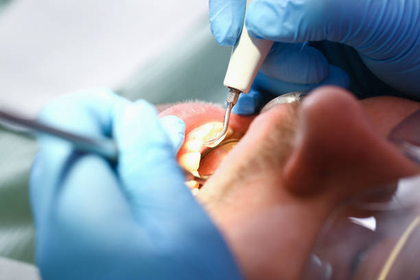 Best Emergency Dental Care for Broken or Chipped Teeth in Cross City, FL