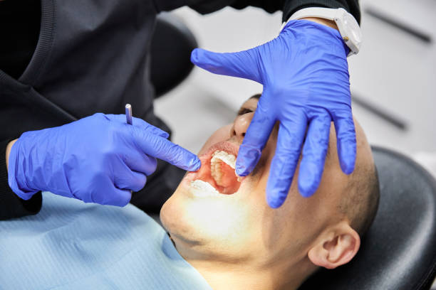 Best Emergency Treatment for Dental Infections or Abscesses in Cross City, FL